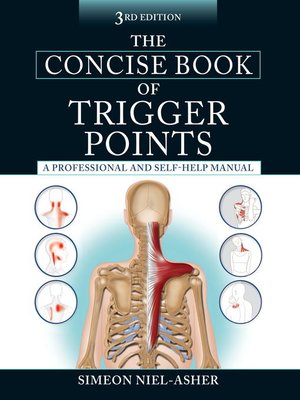 cover image of The Concise Book of Trigger Points